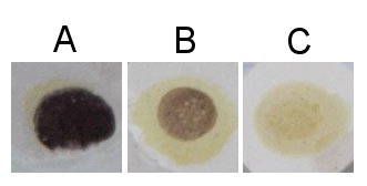 Iodine test.jpg